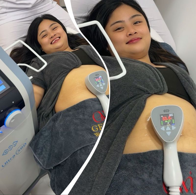 Exilis Body Contouring Exilis Body